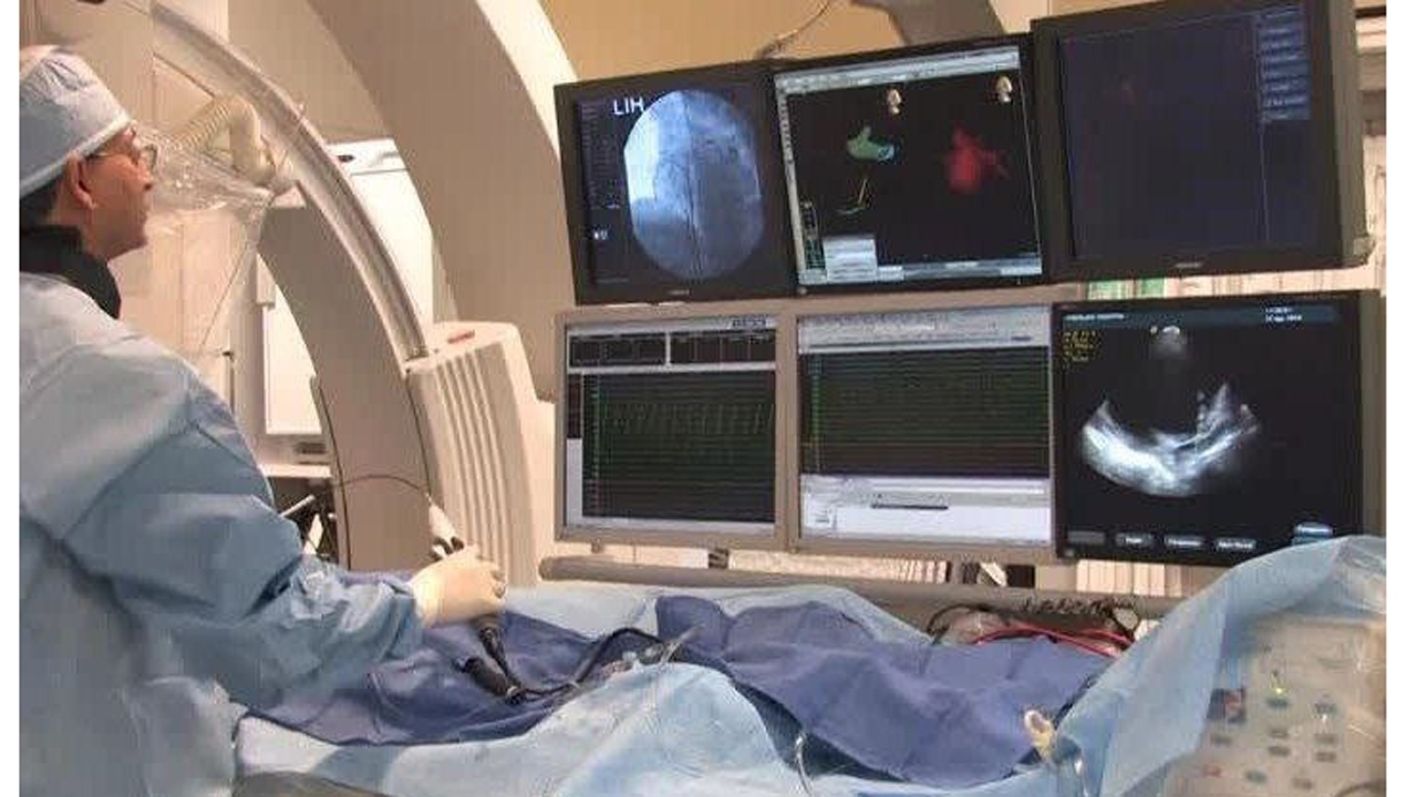 انجام هزار و ۳۰۰ جراحی قلب باز در بیمارستان فاطمه الزهرا (س) ساری